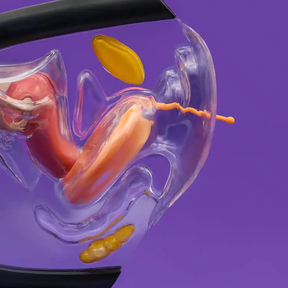 Papayacup menstruatiedisk 4 papaycup menstruatiedisk in vagina voorbeeld